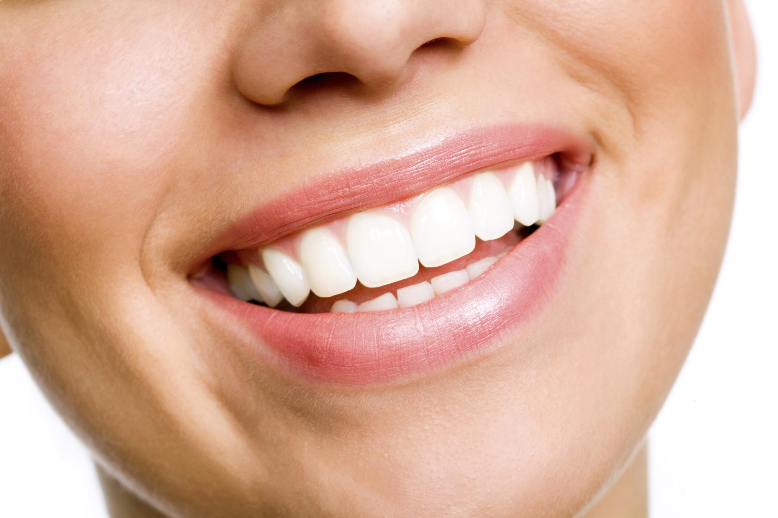 Cara Memutihkan Gigi Secara Alami Tanpa Efek Samping