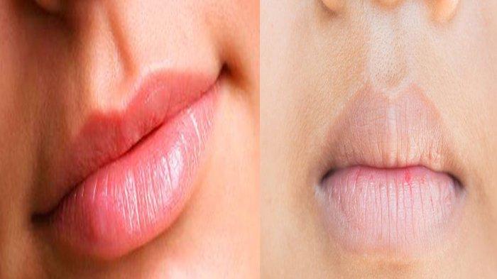 Rahasia Kecantikan Bibir Merah Alami: Tips untuk Merawat dan Mempercantik Bibir Anda